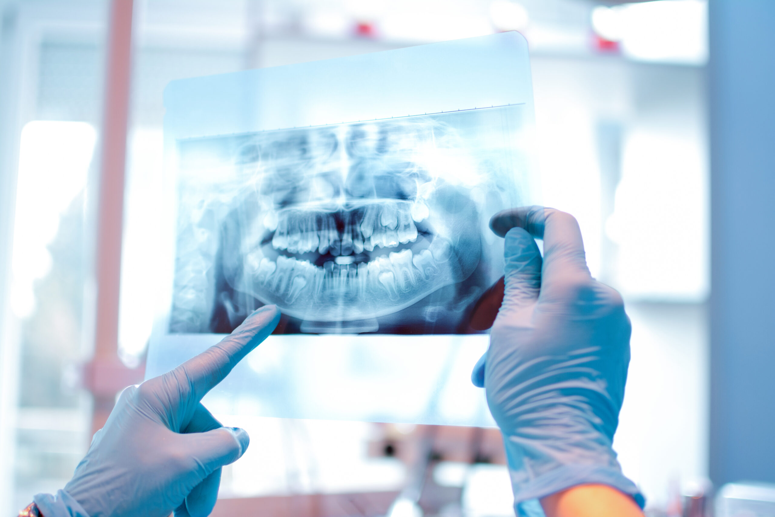 Understanding CBCT Scan at Fleischmann Dentistry in Auburn, CA: Why it’s the Future of Dental Care
